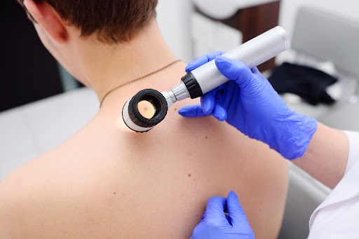 Doctor Dermatologist Examines Birthmarks Of The Patient With Dermatoscope | Patrick Bitter MD in Los Gatos, CA