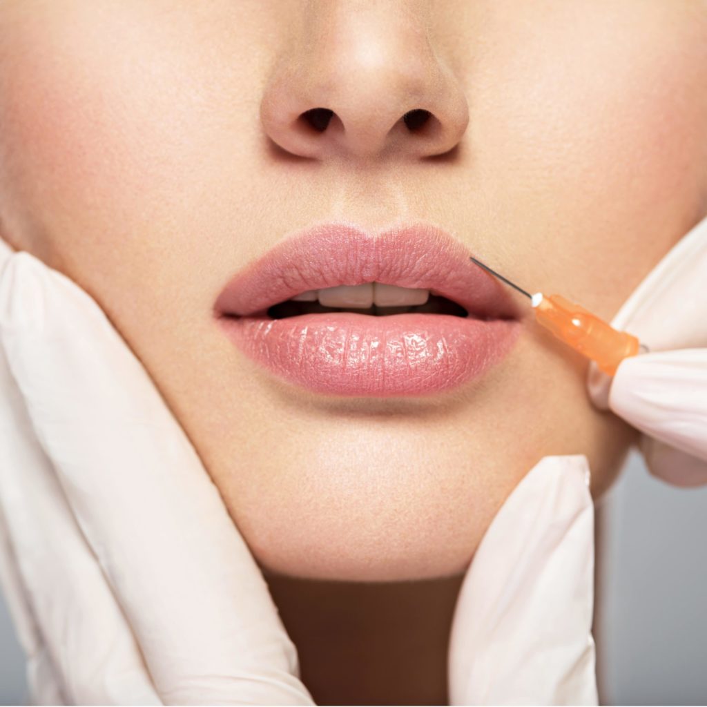 Dermal Fillers & Cosmetic Injectables in Los Gatos, CA | PATRICK BITTER MD