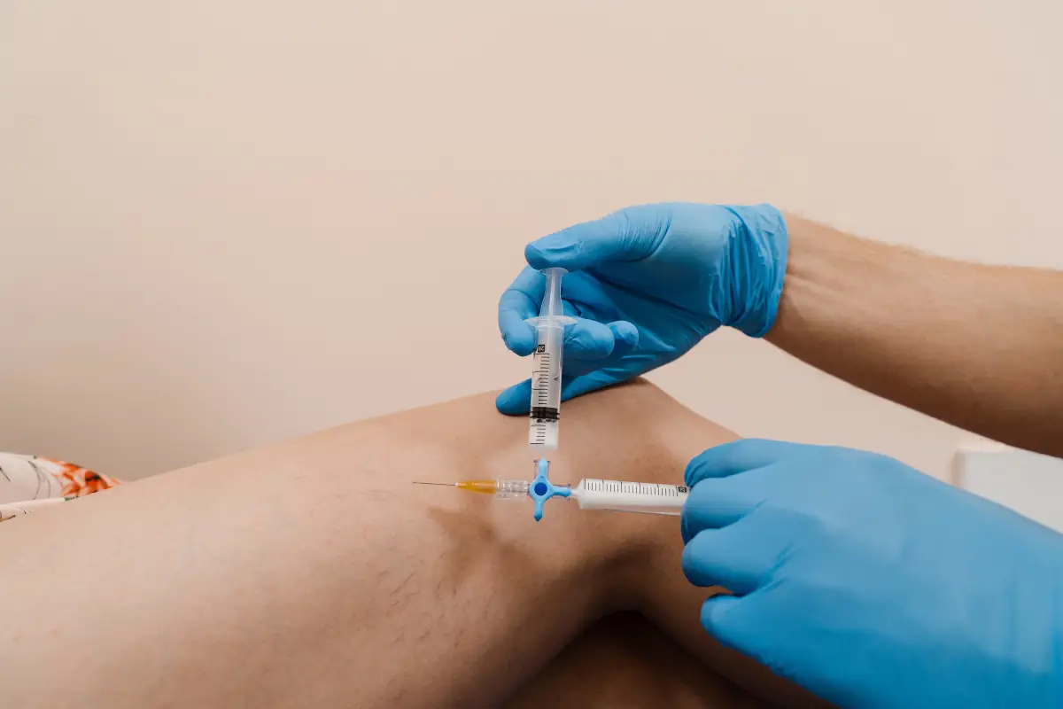 Sclerotherapy Vein Treatment in LOS GATOS, CA PATRICK BITTER JR MD