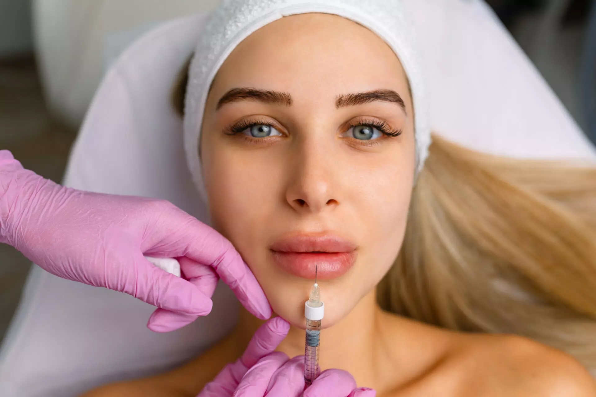 Lip Augmentation by PATRICK BITTER JR MD in Los Gatos, CA